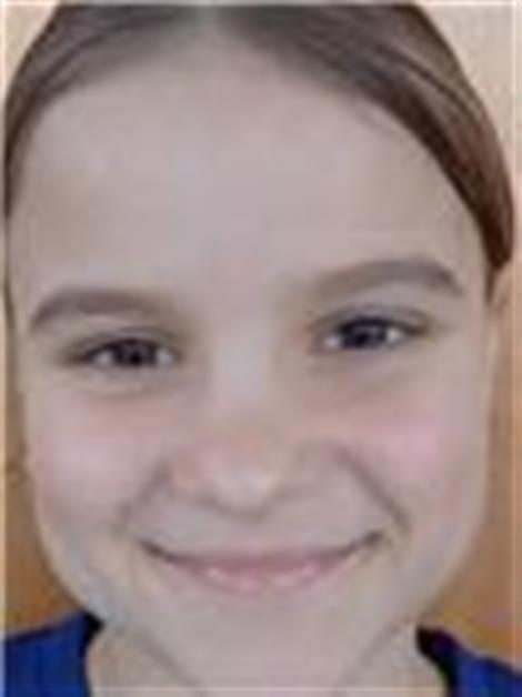 LM