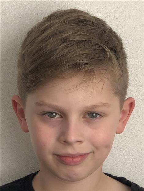 AD